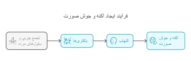 جوش صورت